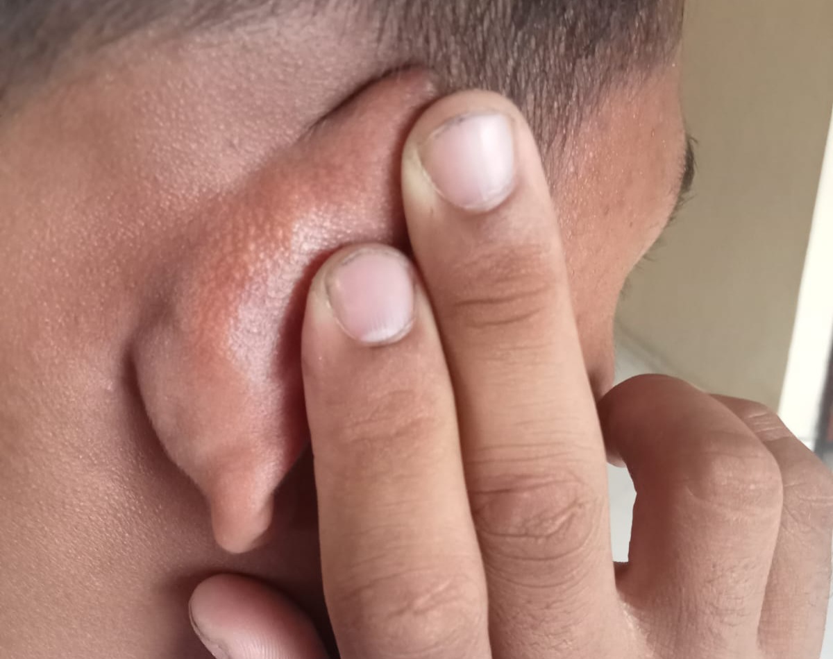 Siswa Diduga Dikeroyok di Lingkungan Sekolah, Respons SMA Negeri 13 Sungai Tutung Dipertanyakan Siswa Diduga Dikeroyok di Lingkungan Sekolah, Respons SMA Negeri 13 Sungai Tutung Dipertanyakan